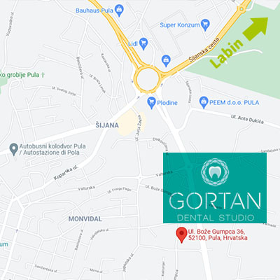 Google Map lokacija